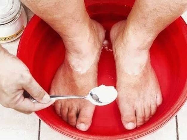 băi de sodiu pentru ciuperci