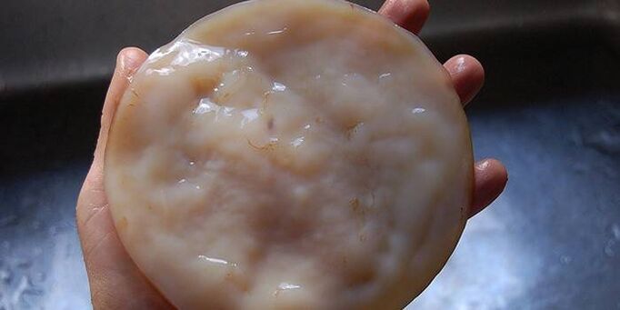 Kombucha pentru ciuperca unghiilor