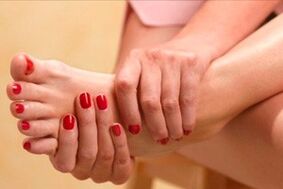 Micoza picioarelor provoacă apariția mâncărimii pielii