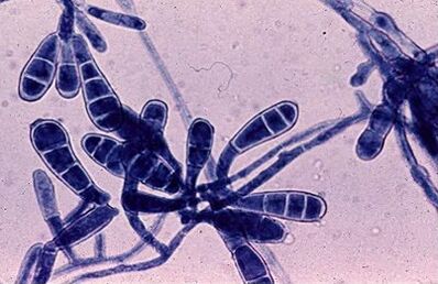 bacterii care provoacă ciupercă de unghii